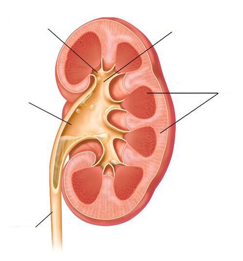 akútna pyelonefritída ako komplikácia cystitídy